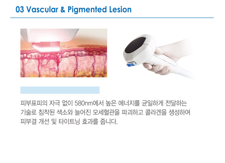 03. Vascular & Pigmented Lesion