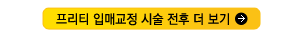 필러_더보기